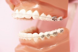 矯正歯科に対する当院の考え方