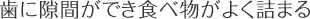 歯に隙間ができ食べ物がよく詰まる