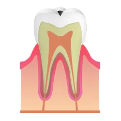 第一段階C1