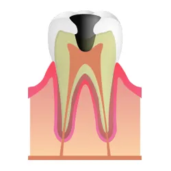 第三段階C3