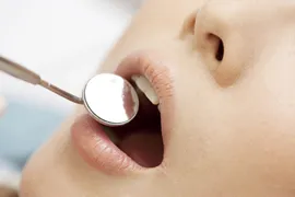 予防治療の重要性